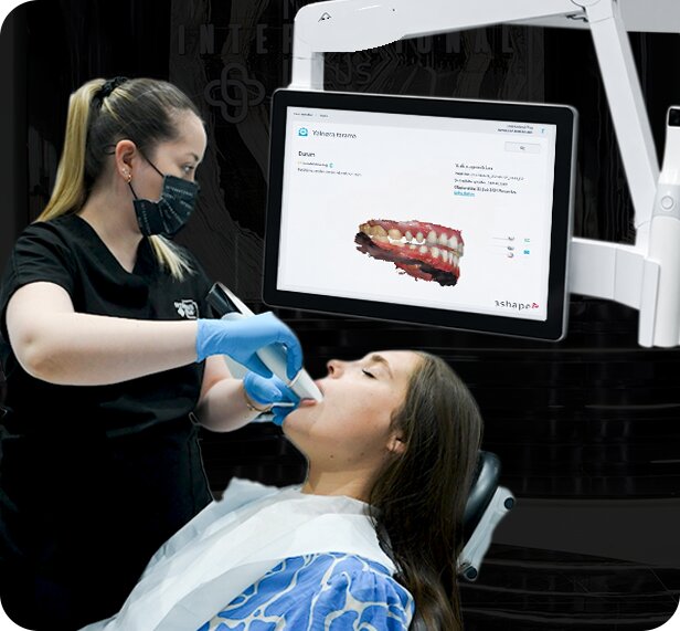 3D Digital Scanning