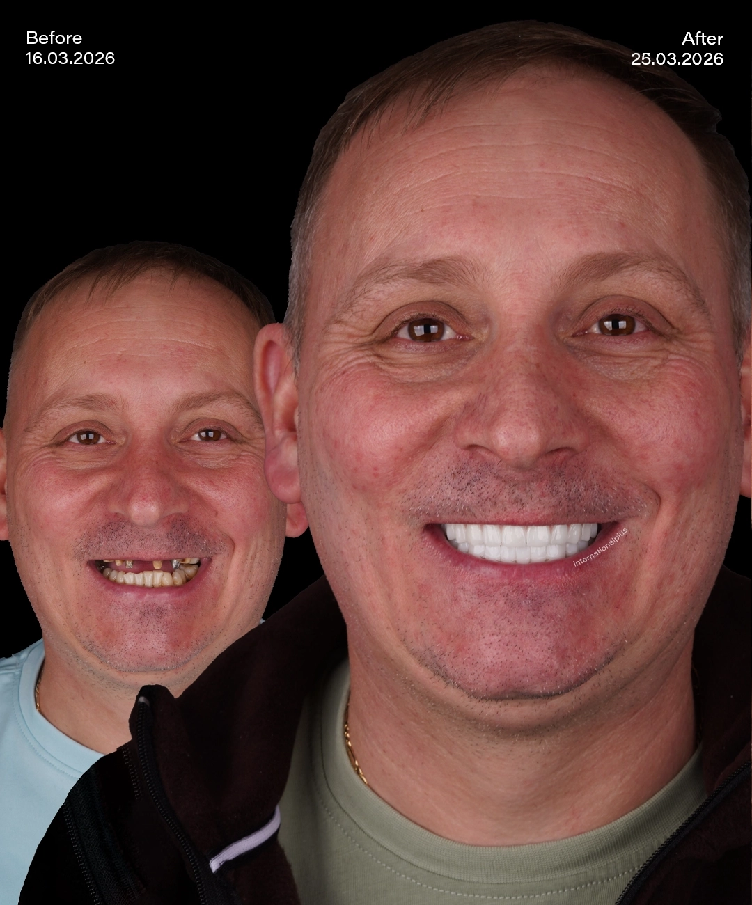 Toronto Dental Systems Before After 2