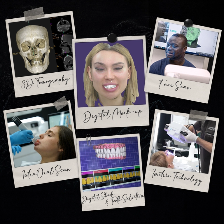 What Are Digital Smile Design