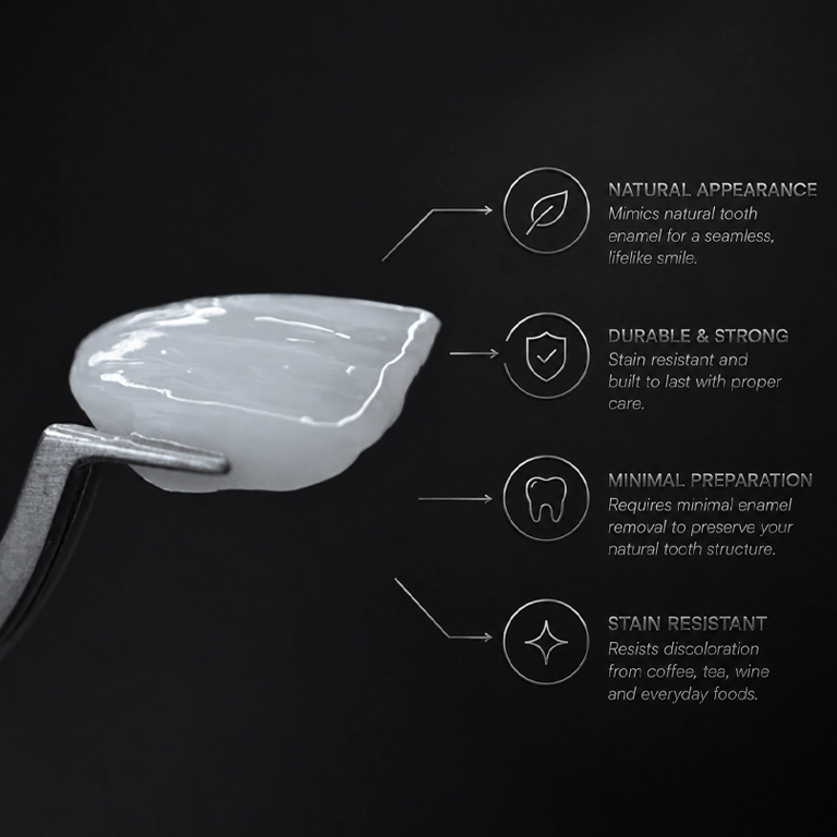What Are Porcelain Veneers