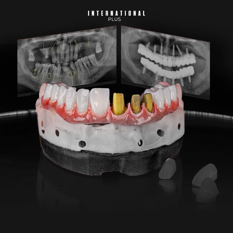 What Are Toronto Dental Systems